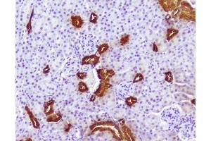 IHC analysis of Calbindin using anti-Calbindin antibody (ABIN6719541). (CALB1 antibody  (AA 2-261))