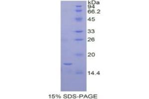 SDS-PAGE analysis of Human IL12Rb2 Protein.