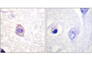 Immunohistochemistry analysis of paraffin-embedded human brain, using Interferon-gamma Receptor alpha (Phospho-Tyr457) Antibody. (IFNGR1 antibody  (pTyr457))