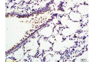 Formalin-fixed and paraffin embedded rat lung labeled with Anti-TNFAIP5/Pentraxin 3 Polyclonal Antibody, Unconjugated (ABIN714686) at 1:200 followed by conjugation to the secondary antibody and DAB staining.