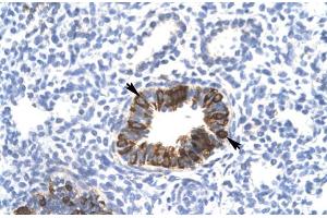 Rabbit Anti-MXI1 Antibody Catalog Number: ARP31403 Paraffin Embedded Tissue: Human Lung Cellular Data: Epithelial cells of bronchiole Antibody Concentration: 4. (MXI1 antibody  (Middle Region))