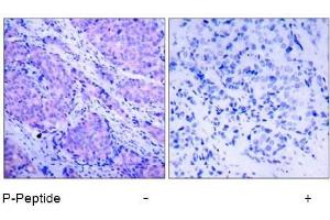 Image no. 1 for anti-3-phosphoinositide Dependent Protein Kinase-1 (PDPK1) (pSer241) antibody (ABIN196616) (PDPK1 antibody  (pSer241))