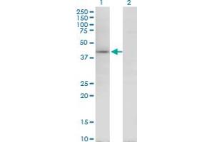 Western Blot analysis of TARBP2 expression in transfected 293T cell line by TARBP2 monoclonal antibody (M08), clone 1G6. (TARBP2 antibody  (AA 1-366))