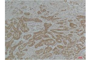Immunohistochemical (IHC) analysis of paraffin-embedded Mouse Brain Tissue using a-tubulin(Acetyl Lys40) Mouse Monoclonal Antibody diluted at 1:200. (alpha Tubulin antibody  (acLys40))