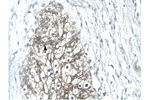 MMP19 antibody was used for immunohistochemistry at a concentration of 4-8 ug/ml to stain Epithelial cells (arrows) in Human Urinary bladder.