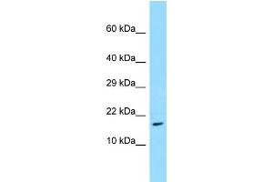 WB Suggested Anti-TRAPPC3 Antibody Titration: 1. (TRAPPC3 antibody  (N-Term))