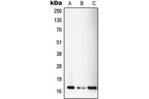 Western blot analysis of SSBP1 expression in A375 (A), HeLa (B), MOLT4 (C) whole cell lysates.
