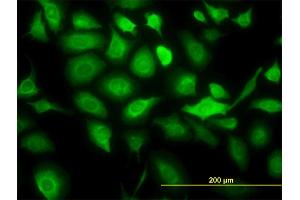 Immunofluorescence of monoclonal antibody to KRT20 on HeLa cell. (KRT20 antibody  (AA 1-424))