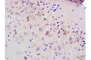 Formalin-fixed and paraffin embedded rat brain tissue labeled Anti-MRP1 Polyclonal Antibody, Unconjugated  at 1:200, followed by conjugation to the secondary antibody and DAB staining (MRP1 antibody  (AA 501-600))