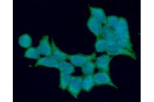ICC/IF analysis of ALDH5A1 in 293T cells line, stained with DAPI (Blue) for nucleus staining and monoclonal anti-human ALDH5A1 antibody (1:100) with goat anti-mouse IgG-Alexa fluor 488 conjugate (Green). (ALDH5A1 antibody)