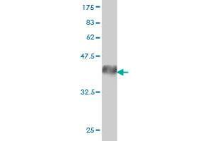 Western Blotting (WB) image for anti-EPH Receptor A3 (EPHA3) (AA 202-326) antibody (ABIN560754)