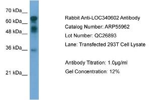 WB Suggested Anti-CXorf67  Antibody Titration: 0. (CXorf67 antibody  (Middle Region))