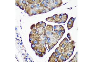 Immunohistochemistry of paraffin-embedded Mouse pancreas using  Rabbit pAb (ABIN7265696) at dilution of 1:100 (40x lens). (ALG5 antibody  (AA 34-190))