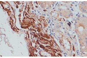 Immunohistochemistry of paraffin-embedded Human stomach using DES Polyclonal Antibody at dilution of 1:100 (40x lens). (Desmin antibody)