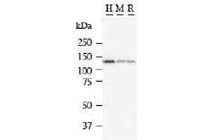 Image no. 1 for anti-Matrin 3 (MATR3) antibody (ABIN328222) (MATR3 antibody)