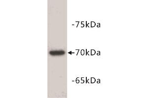 Western Blotting (WB) image for anti-alpha-Fetoprotein (AFP) (C-Term) antibody (ABIN1854824) (alpha Fetoprotein antibody  (C-Term))