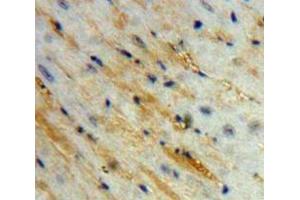Used in DAB staining on fromalin fixed paraffin-embedded Heart tissue (Corin antibody  (AA 334-477))