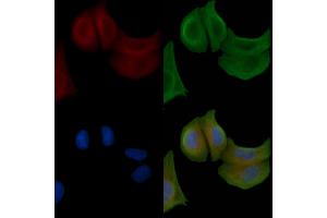 ABIN6258515 and ABIN6274734 staining Hela cells by IF/ICC.