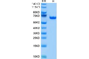 Human BTN1A1 on Tris-Bis PAGE under reduced condition. (BTN1A1 Protein (AA 27-242) (Fc Tag))
