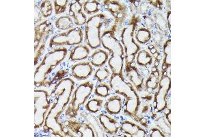 Immunohistochemistry of paraffin-embedded mouse kidney using VD Rabbit pAb (ABIN6130775, ABIN6150077, ABIN6150078 and ABIN6214830) at dilution of 1:25 (40x lens). (VDAC3 antibody  (AA 1-283))