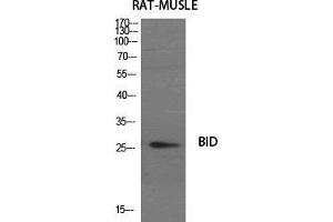 Western Blot (WB) analysis of specific cells using BID Polyclonal Antibody. (BID antibody  (Internal Region))
