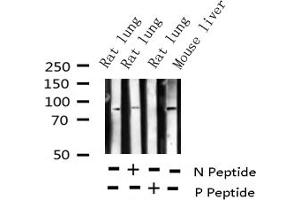 Western blot analysis of Phospho-Cortactin (Tyr421) expression in various lysates (Cortactin antibody  (pTyr421))
