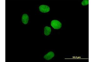 Immunofluorescence of purified MaxPab antibody to XRCC4 on HeLa cell. (XRCC4 antibody  (AA 1-336))