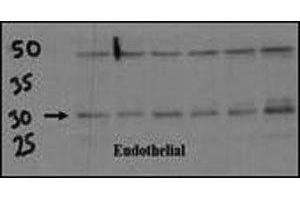 Endothelial cell lysate transferred to membrane was incubated with DSCR1 antibody at a 1:500 dilution. (RCAN1 antibody  (AA 222-252))