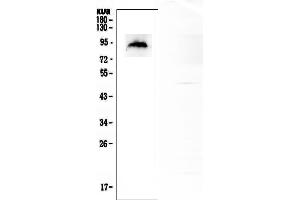 Western Blotting (WB) image for anti-Mdm2, p53 E3 Ubiquitin Protein Ligase Homolog (Mouse) (MDM2) (AA 343-358), (C-Term) antibody (ABIN5518668)