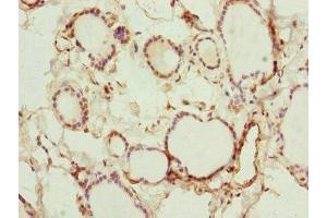 Immunohistochemistry of paraffin-embedded human thyroid tissue using ABIN7151127 at dilution of 1:100 (RNF114 antibody  (AA 1-228))