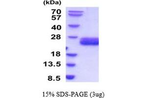 SDS-PAGE (SDS) image for Interleukin 6 (IL6) (AA 25-211) (Active) protein (His tag) (ABIN7281010)