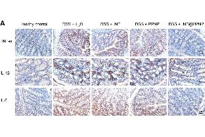(A) Immunohistochemical staining for TNF-α, IL-1β, and IL-6 in colon tissues of different groups. (IL-6 antibody  (AA 30-212))
