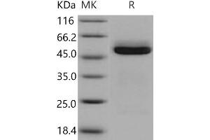 Western Blotting (WB) image for Cathepsin A (CTSA) protein (His tag) (ABIN7320306) (CTSA Protein (His tag))