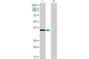 Western Blot analysis of TSTA3 expression in transfected 293T cell line by TSTA3 monoclonal antibody (M01), clone 2B9.