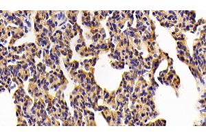 Detection of TLR2 in Porcine Lung Tissue using Polyclonal Antibody to Toll Like Receptor 2 (TLR2) (TLR2 antibody  (AA 47-245))