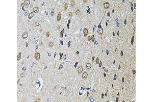 Immunohistochemistry (Paraffin-embedded Sections) (IHC (p)) image for anti-Protein tyrosine Phosphatase, Receptor Type, E (PTPRE) antibody (ABIN7263191)