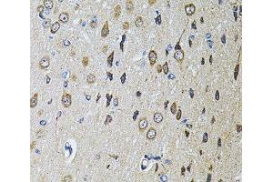 Immunohistochemistry of paraffin-embedded Rat brain using PTPRE Polyclonal Antibody at dilution of 1:100 (40x lens). (PTPRE antibody)