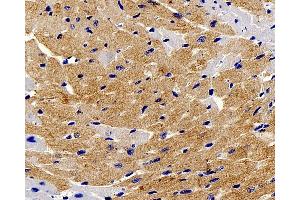 Immunohistochemistry analysis of paraffin-embedded mouse heart using TNNT2 Polyclonal Antibody at dilution of 1:200. (Cardiac Troponin T2 antibody)