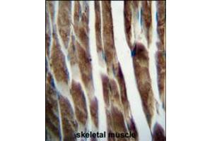 ILKAP Antibody immunohistochemistry analysis in formalin fixed and paraffin embedded human skeletal muscle followed by peroxidase conjugation of the secondary antibody and DAB staining. (ILKAP antibody  (AA 243-270))