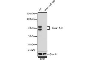 Western blot analysis of extracts from wild type (WT) and Lamin A/C knockout (KO) HeLa cells, using Lamin A/C antibody (ABIN7268177) at 1:50000 dilution. (Lamin A/C antibody)