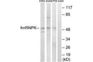 Western blot analysis of extracts from K562/A549/HT-29 cells, using hnRNP K (Ab-284) Antibody.