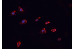 ABIN6266458 staining MCF-7 cells by IF/ICC. (MUC1 antibody  (pTyr1229))