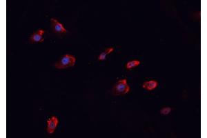 Immunofluorescence (fixed cells) (IF/ICC) image for anti-Mucin 1 (MUC1) (pTyr1229) antibody (ABIN6255791)