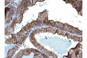 IHC-P Image alpha Adducin antibody detects alpha Adducin protein at membrane on mouse prostate by immunohistochemical analysis. (alpha Adducin antibody)