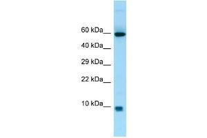 WB Suggested Anti-S100A7A Antibody Titration: 1. (S100A7A antibody  (Middle Region))