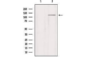 Western blot analysis of extracts from HepG2, using GRID2 Antibody.