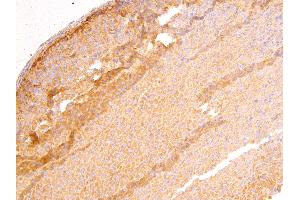 ABIN185264 (4µg/ml) staining of paraffin embedded Mouse Adrenal Gland. (DLC1 antibody  (N-Term))