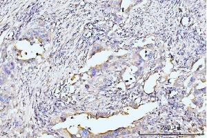 IHC analysis of RPL29 using anti-RPL29 antibody (ABIN7600993). (RPL29 antibody  (AA 27-153))