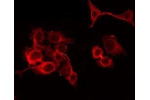 ABIN6279648 staining Hela by IF/ICC. (PAOX antibody  (Internal Region))