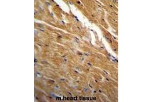 Formalin Fixed, Paraffin Embedded Mouse heart tissue stained with TBC1D13 Antibody (Center) followed by peroxidase conjugation of the secondary antibody and DAB staining.